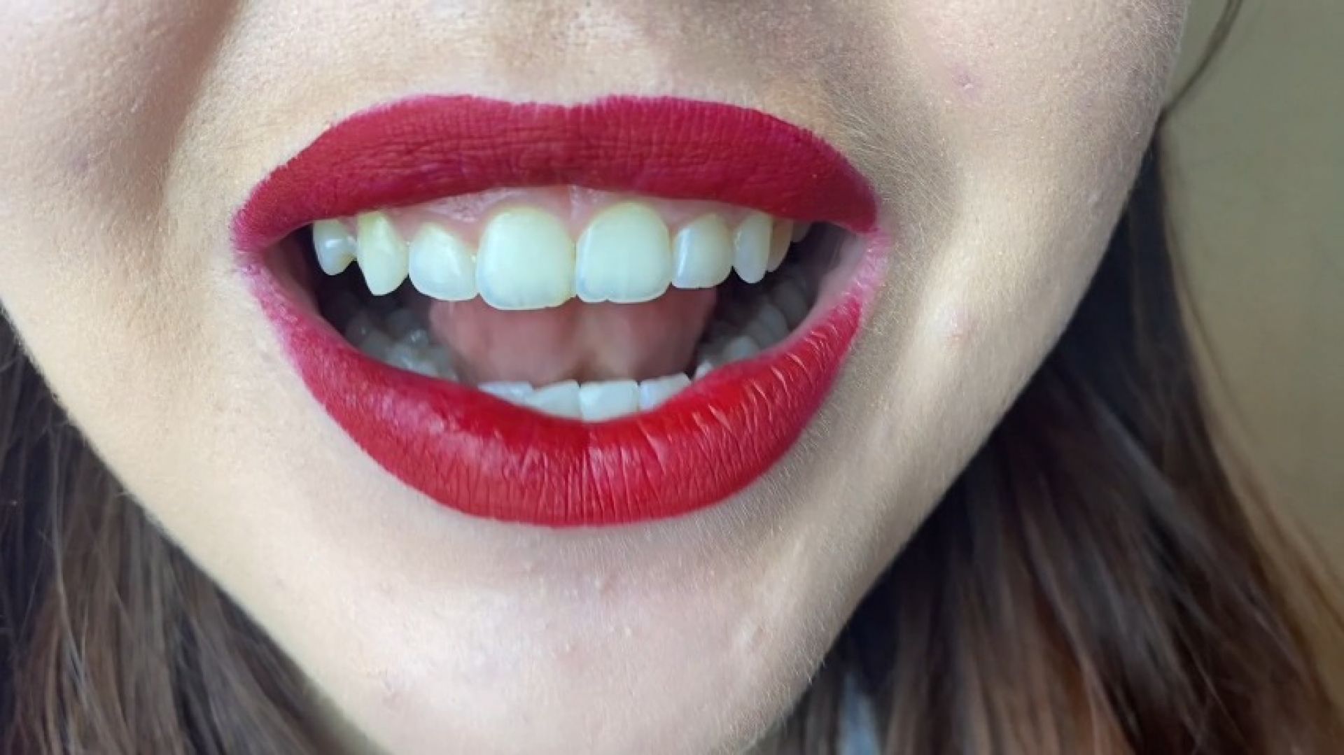 tongue and uvula close up views