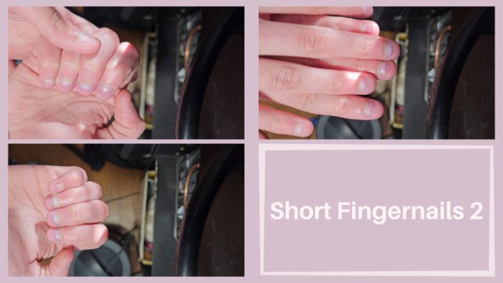 Short Fingernails Up Close 2 CUSTOM