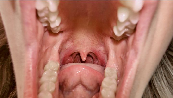 20 Minutes of Uvula Views
