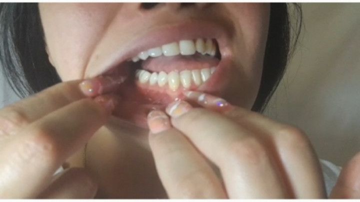 Dirty and yellow teeth in close-up