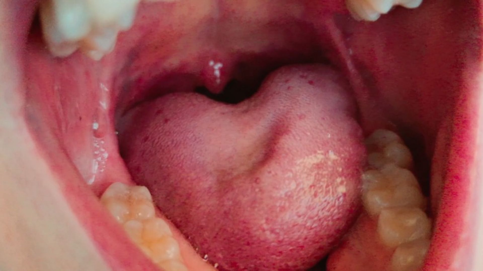 Giantess swallows tiny man whole, thinking he is a fish