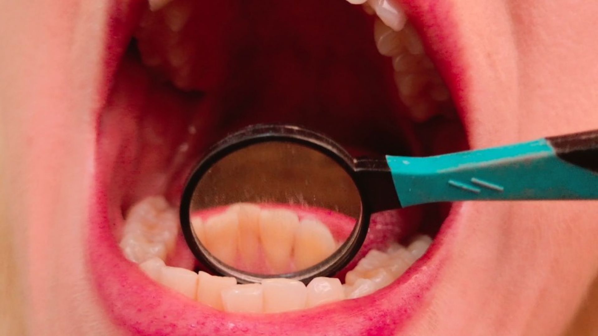 Mouth Tour - Teeth Fetish