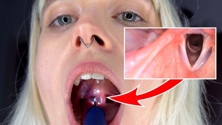 Tiny dentist examines Freya's guts