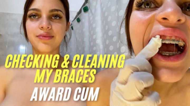 FETISH - BRACES CHECK WITH MOUTH MIRROR AND CUM ON TEETH