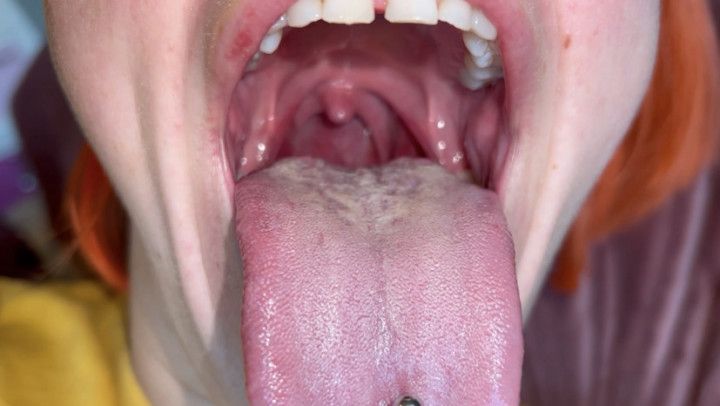 Yawning close up bad breath