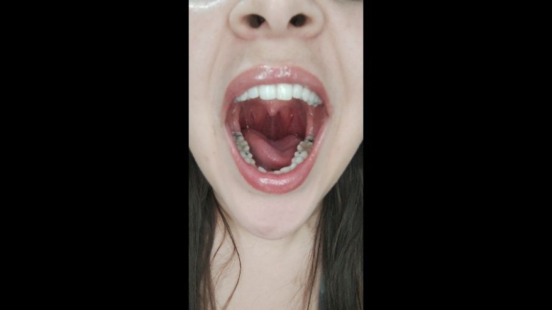 Come take a tour of my mouth