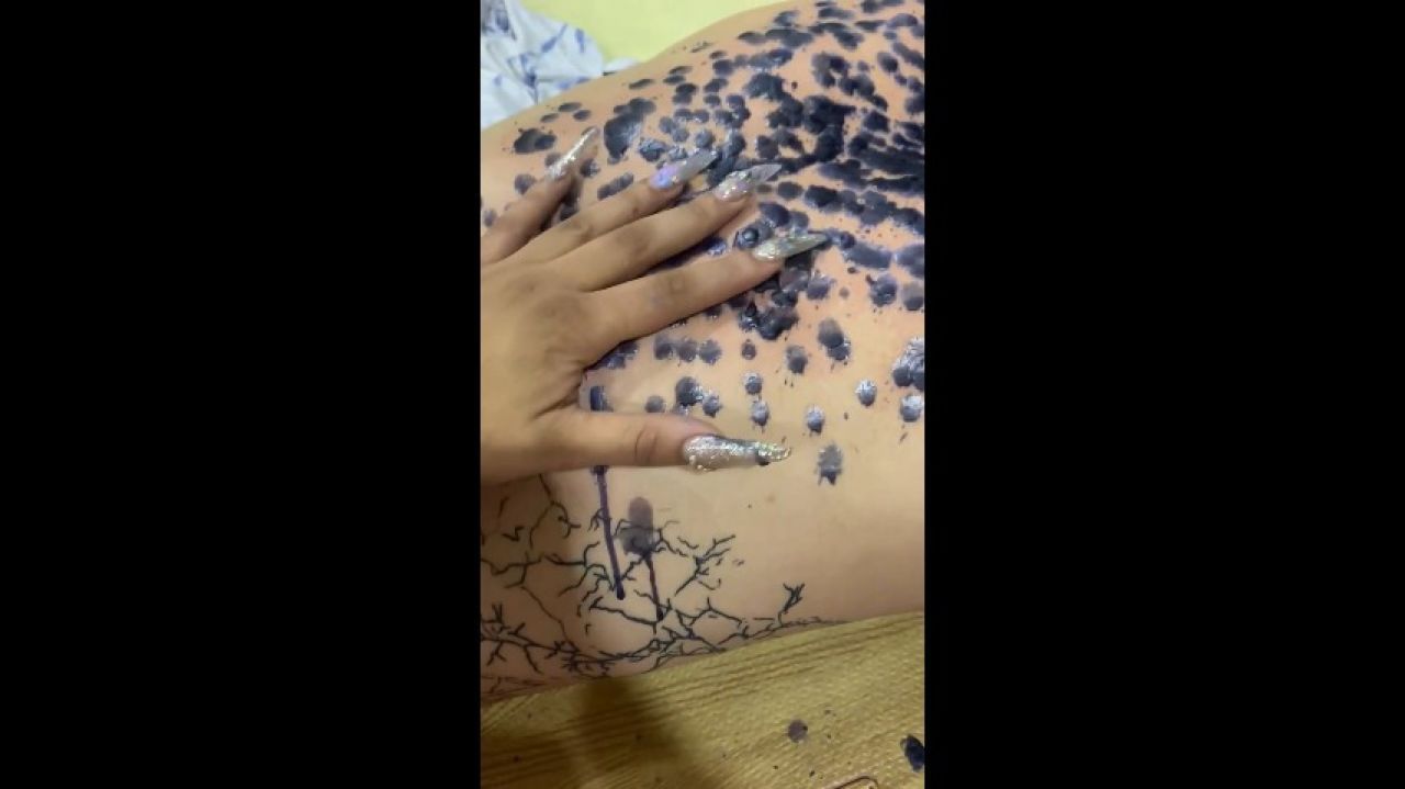 removing wax from my back