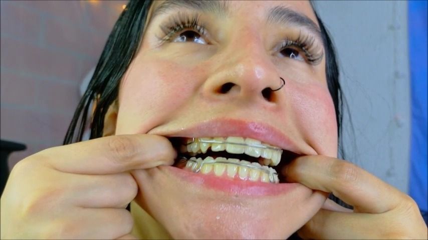 RETAINERS game with a bit of SALIVA