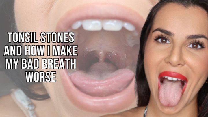 Tonsil stones and my bad breath worst - Lalo Cortez