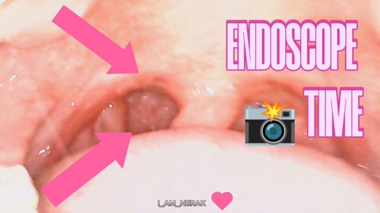 ENDOSCOPE TIME 2.0