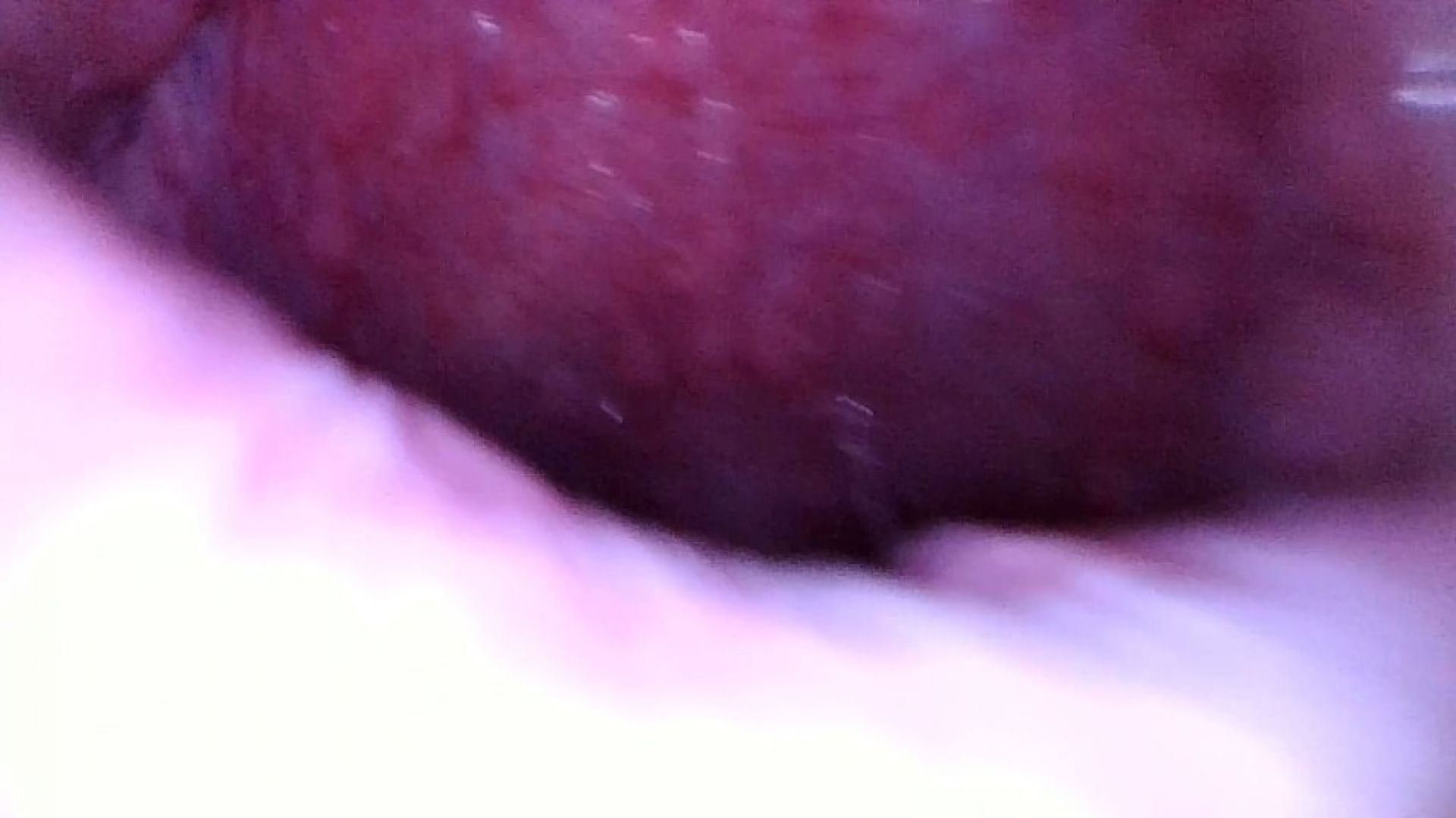 endosocopy mouth