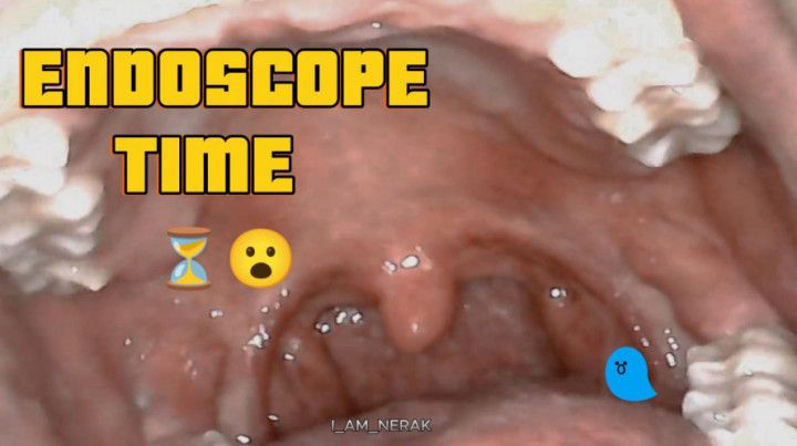 ENDOSCOPE TIME