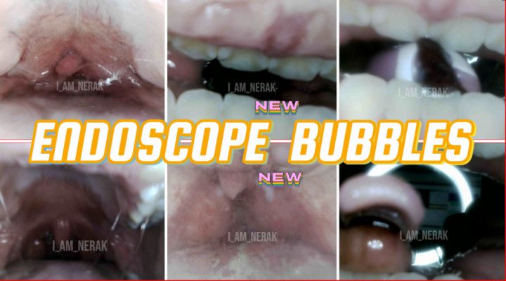 endoscopy bubbles