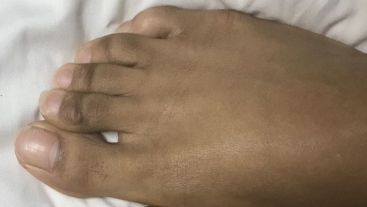 Ebony Feet Rub/Crush Ice