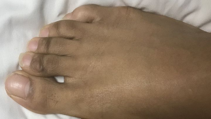 Soy Sauce and Salad Dressing Foot Soak