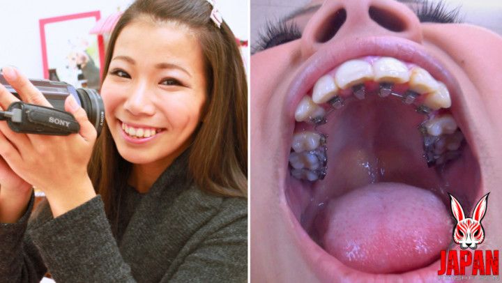 Orthodontic Teeth Fetish : Izumi Asato's Dental Fantasy