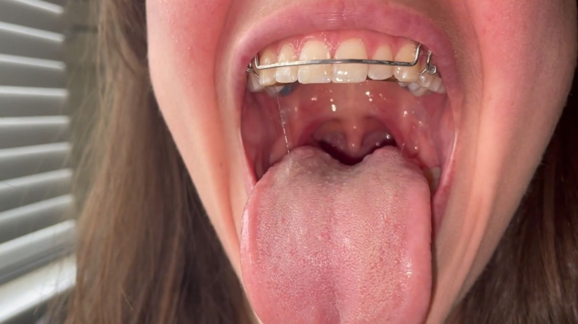 Mouth Tour with my Retainer