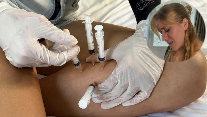 4 injections in the CALF