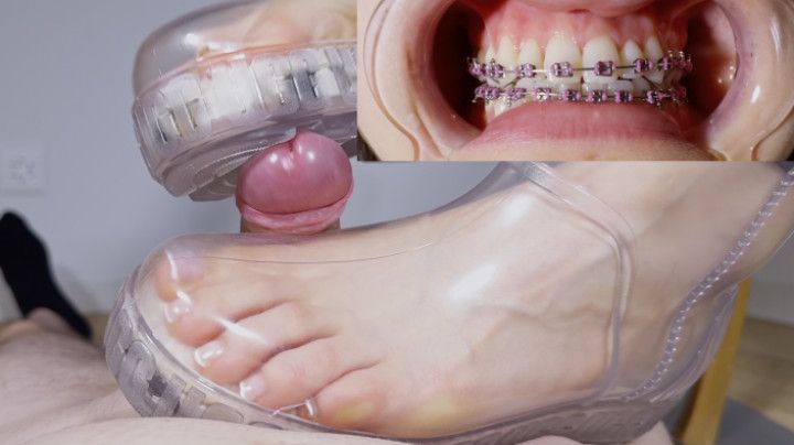 Shoejob with CLEAR UGGS and BRACES