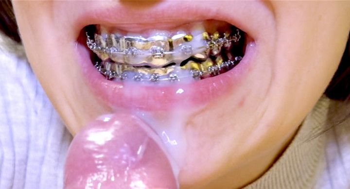 ALL-METAL Braces &amp; Adidas Shoejob, SWISS dirty talk