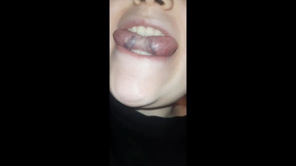 I CHECK MY TONGUE VEINS AND TONSIL