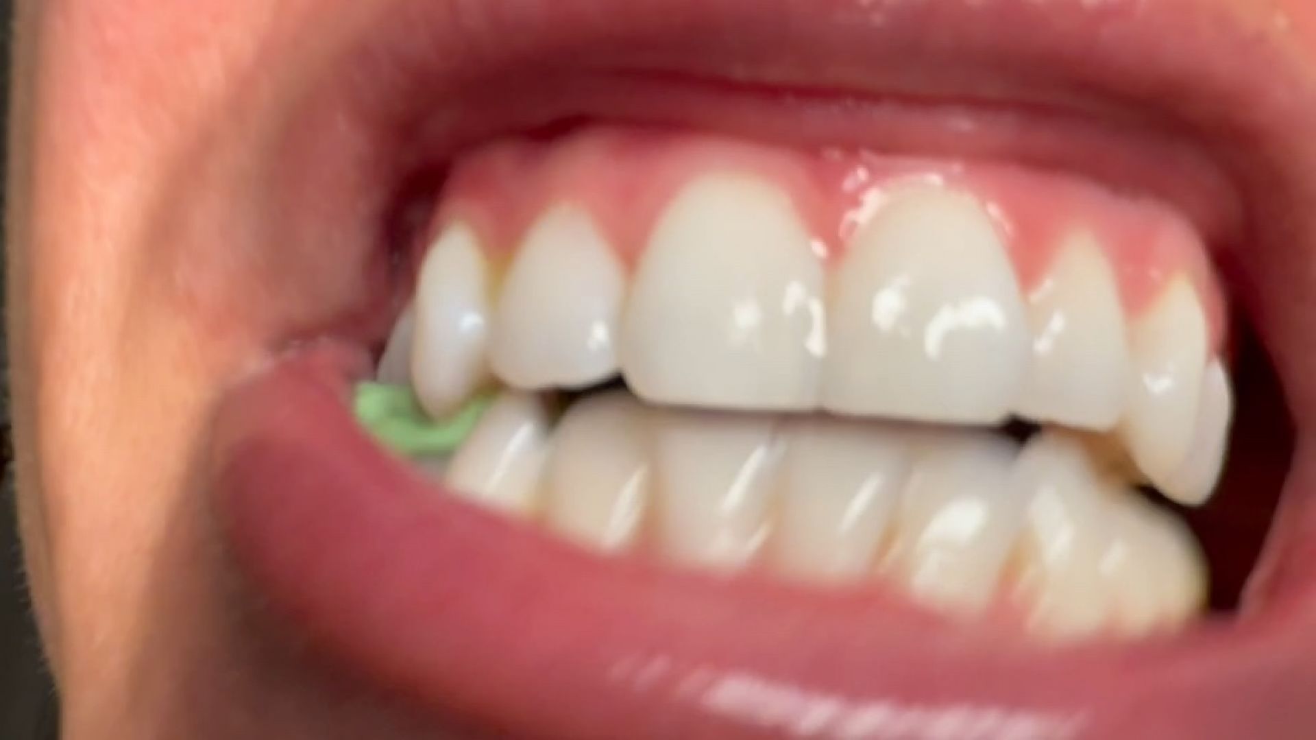 Worship &amp; Eat My Chewed Gum