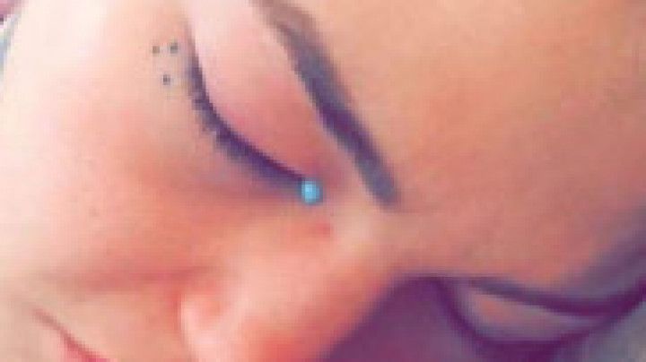 AMBER LUKE BOTCHED EYEBALL TATTOO PROCEDURE