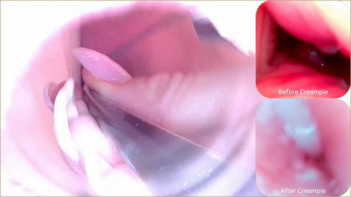 Camera Inside Real Vagina Before & After Creampie - Cervix P