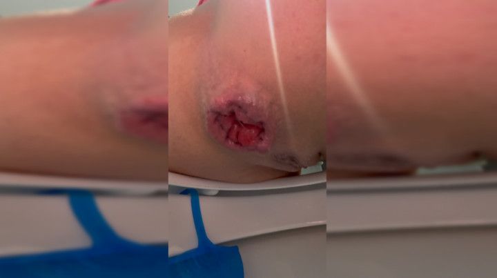 Rose Mia Out push hard prolapse