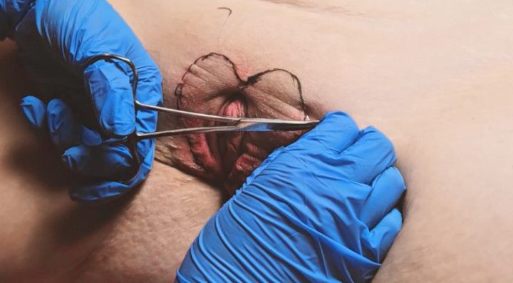 EXTREME Pussy Sewing, Pain, Screaming - Very Good Quality