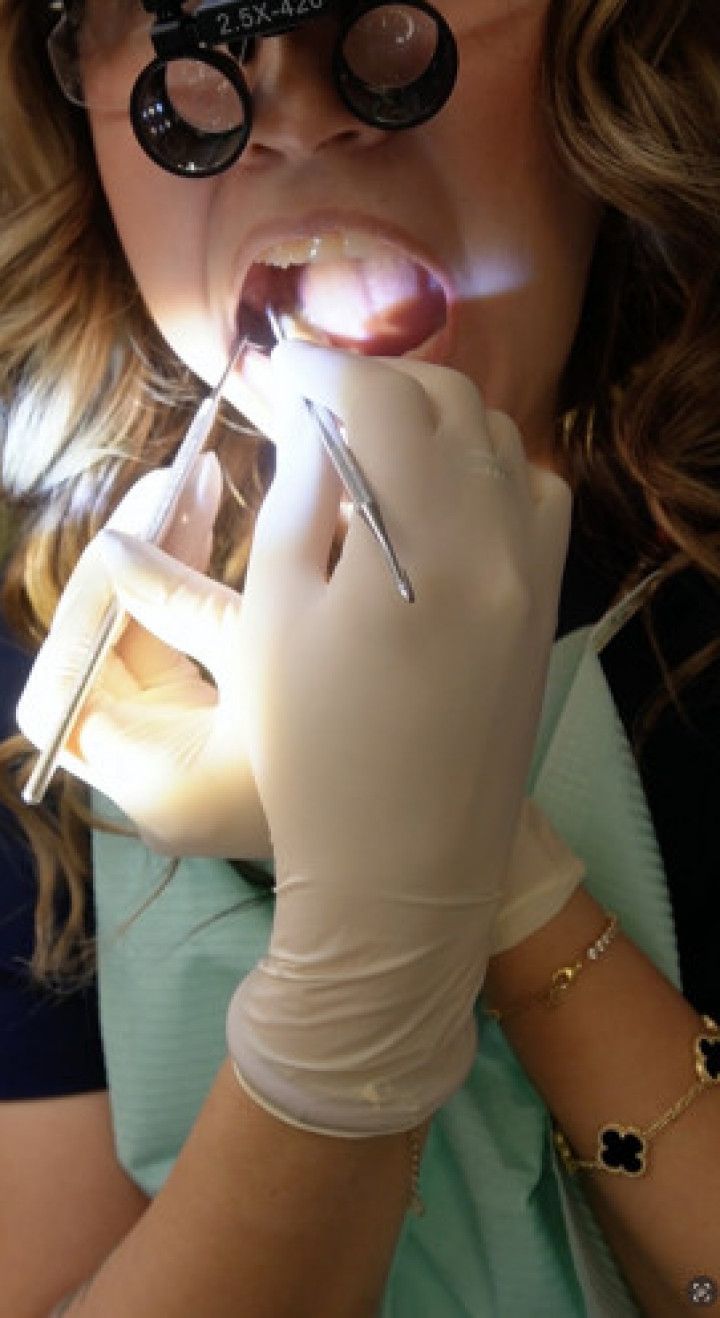 11 Min Self dentistry Watch me clean my teeth