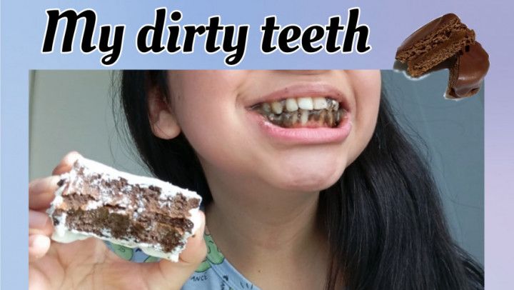 My dirty teeth