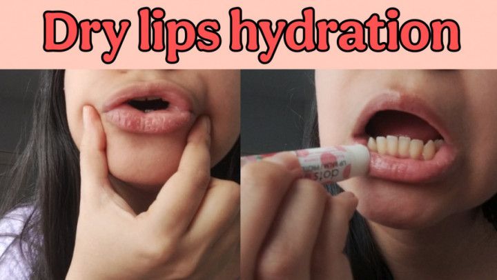 Dry lips hydration