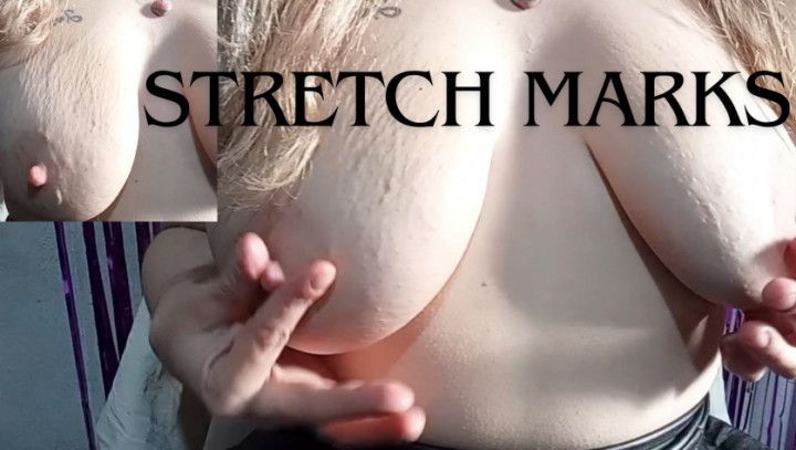 Stretch marks on natural and real tits