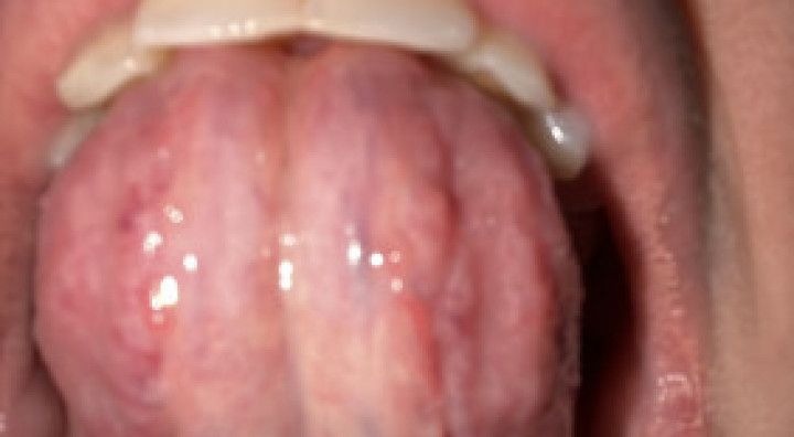 Under Tongue