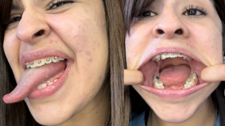 Tongue fetish , big mouth , open mouth