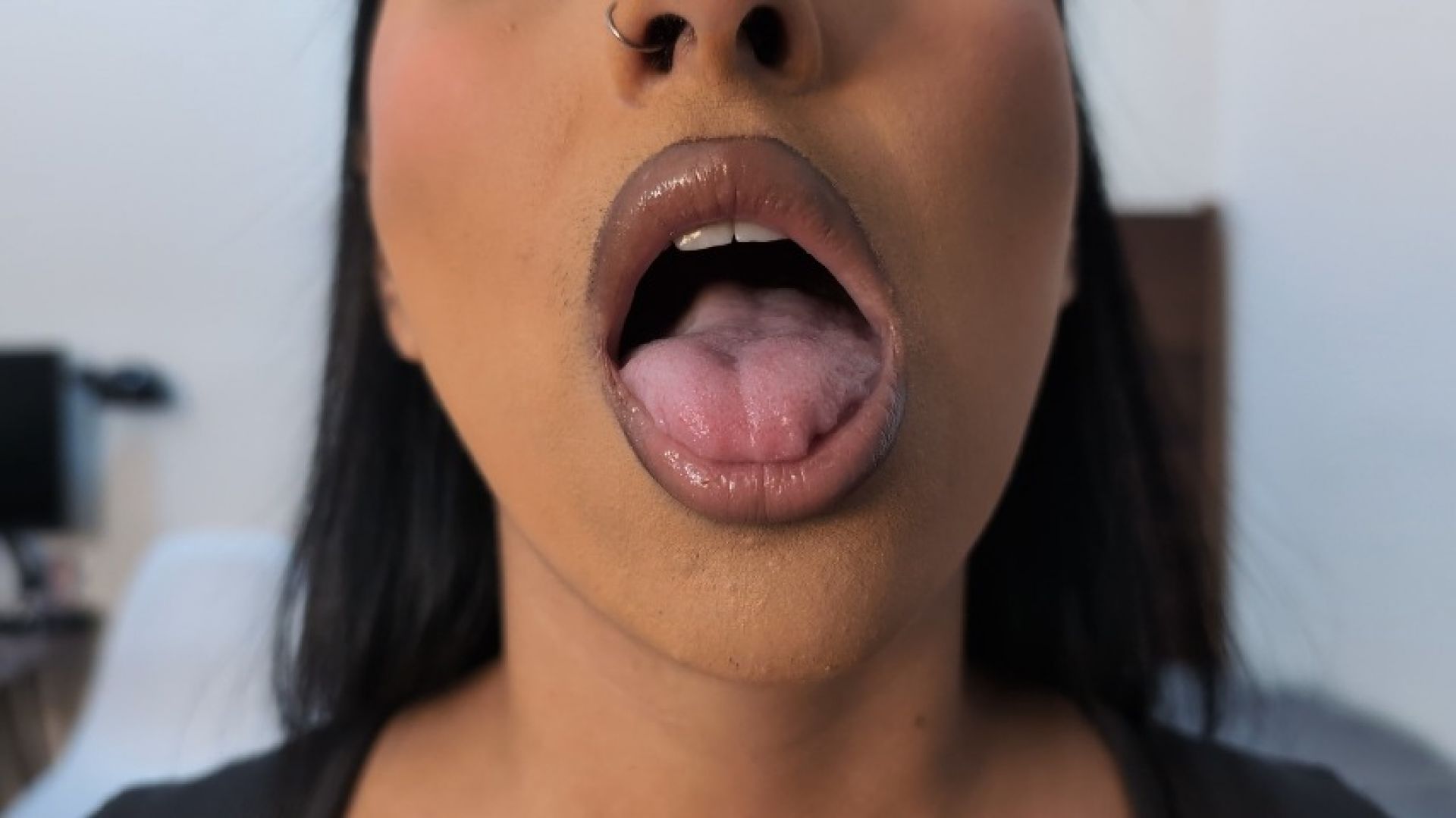 ORAL EXAMINATION | Valerie