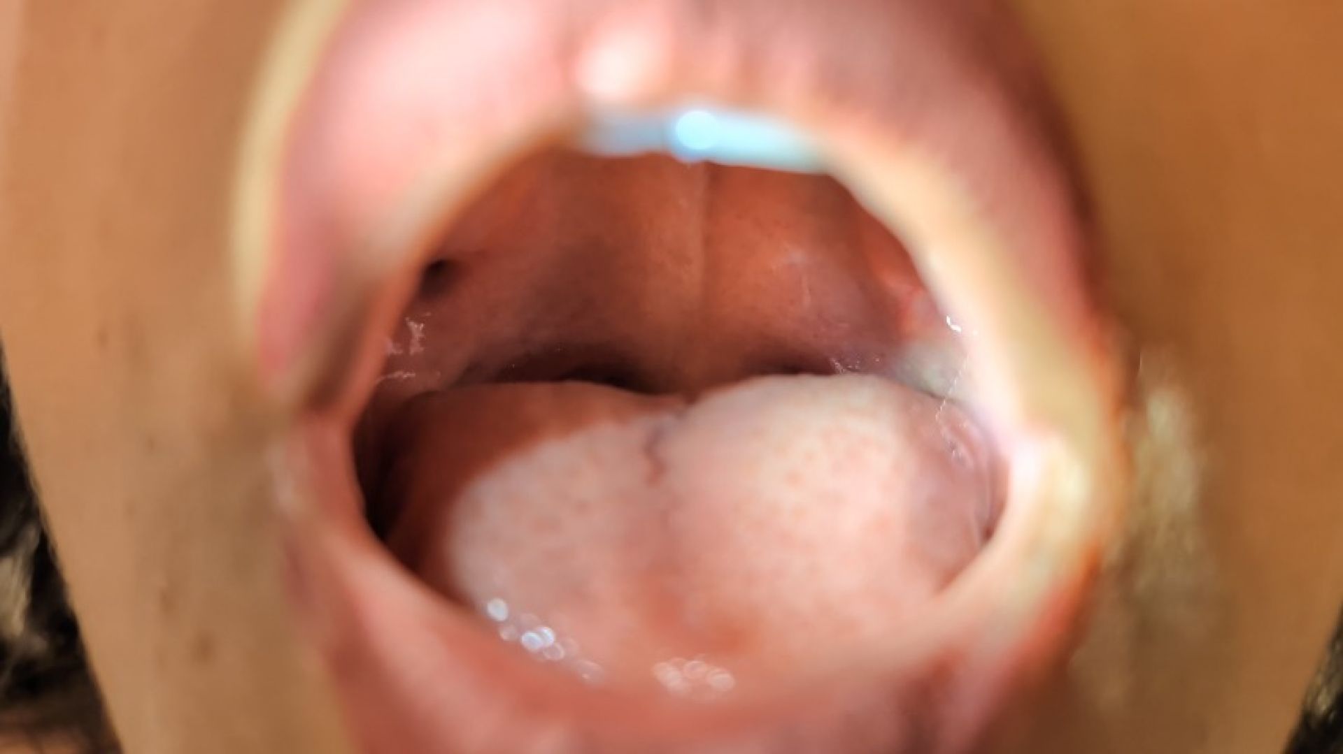 ORAL EXAMINATION: MOUTH OF LIGHT | Laura