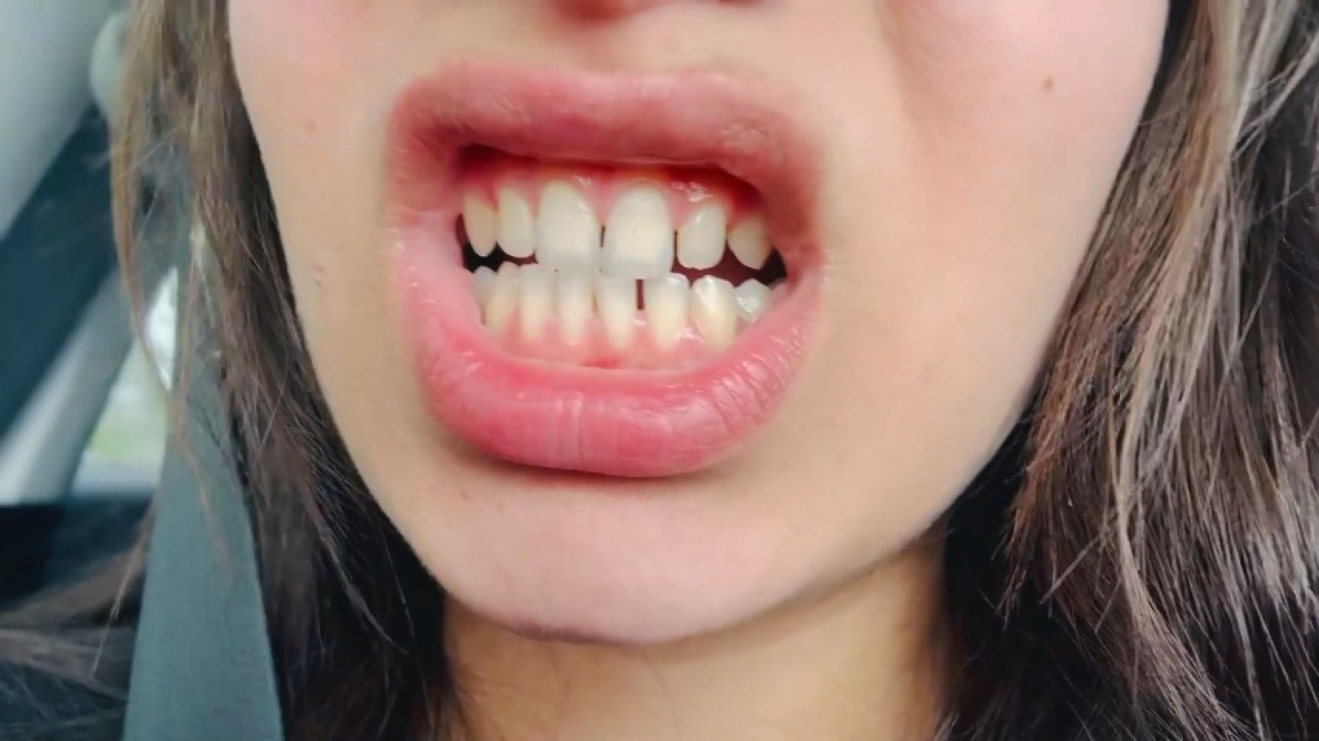 SQUARE LIPS, and teeth and tongues car