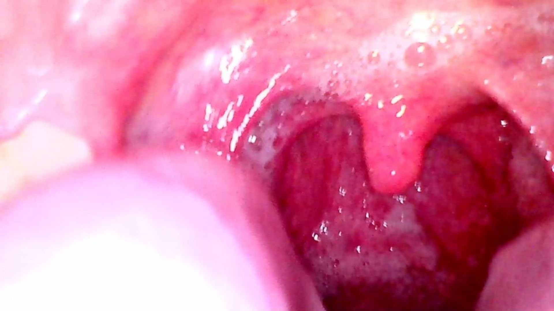 endoscopio mouth asshole gape joi dirtytalk