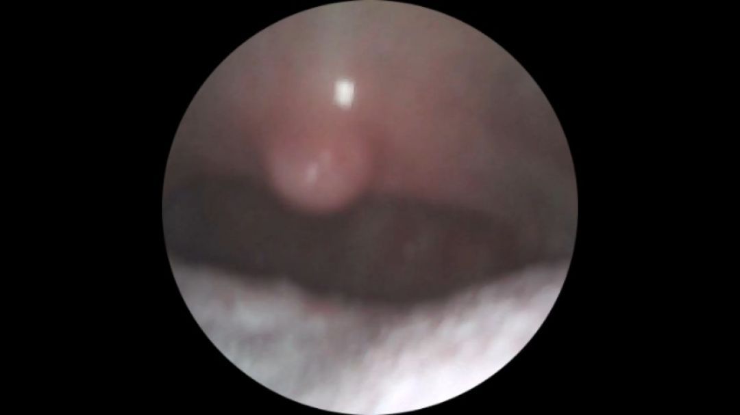 you are my tiny fucking my throat- endoscope view