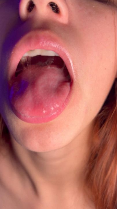 braces mouth fetish