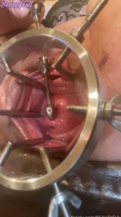 Up Close With My Cervix