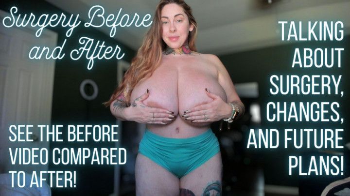 Surgery Before and After