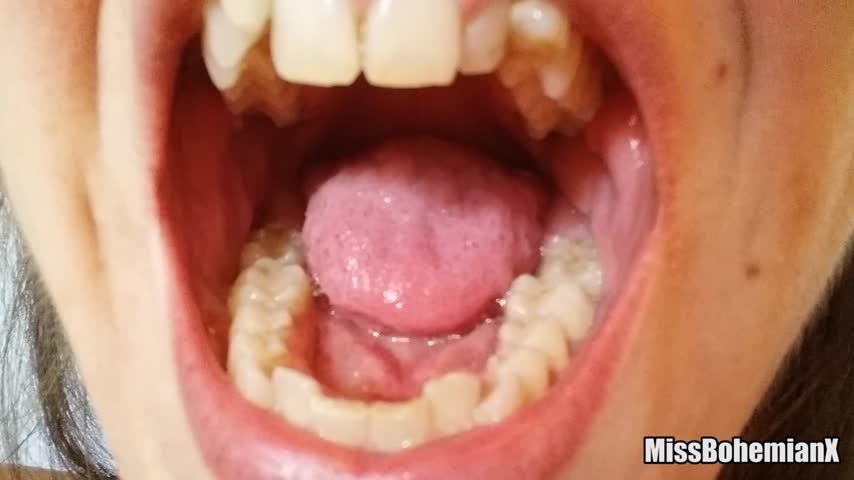 First Mouth Tour - Small Teeth