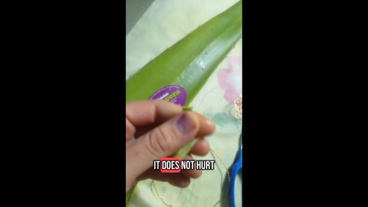 Sabila: Aloe Vera to treat wounds #beauty #health #firstaid