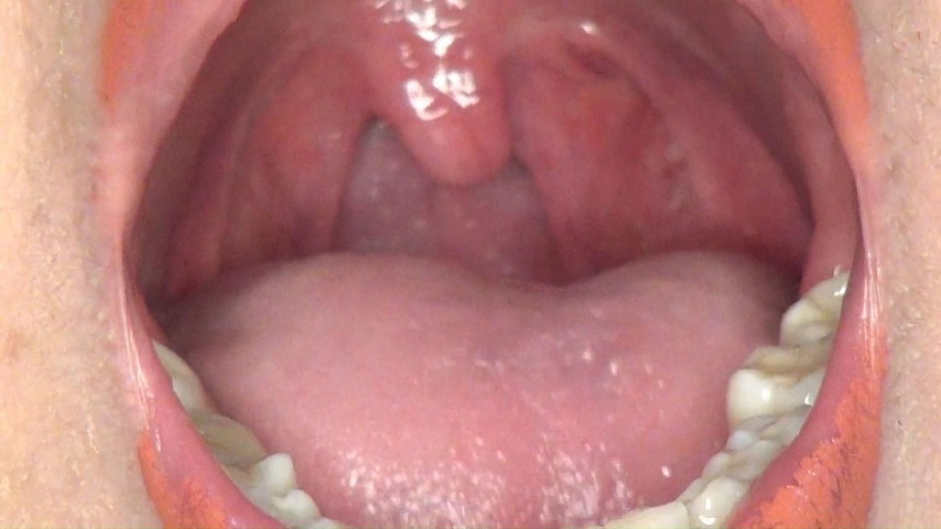 OMG! I swallowed big flamingos at same time