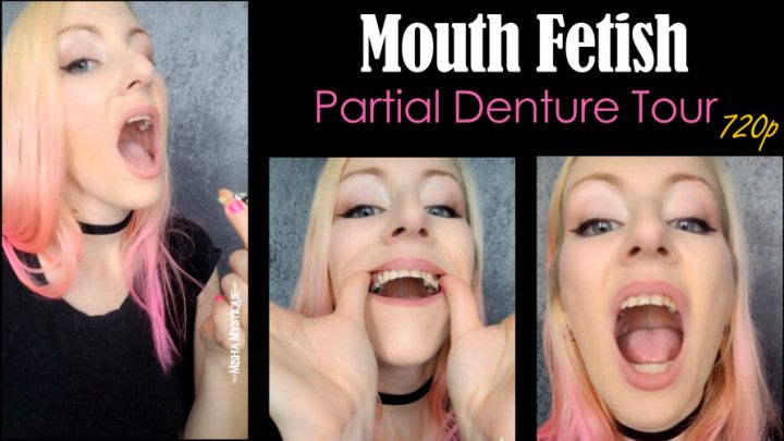 Mouth Fetish: Partial Denture Tour