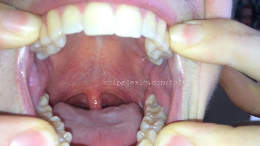 Logan Mouth Part3 Video1