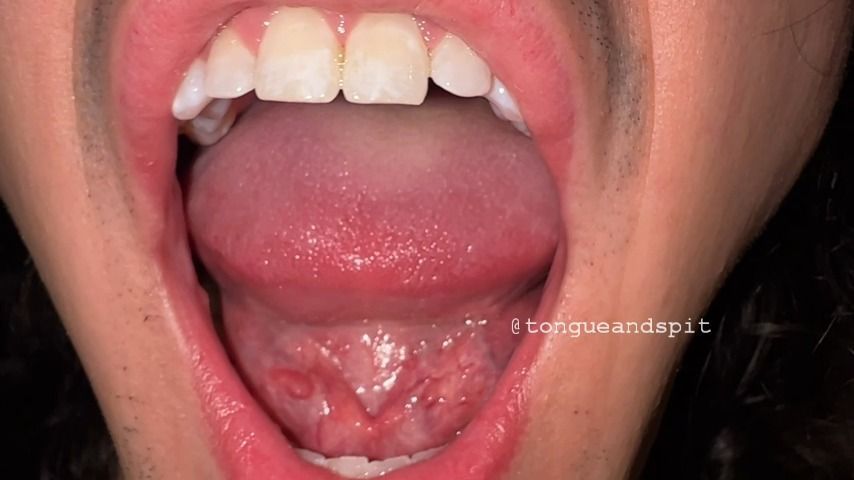 Apollo Mouth Video 1